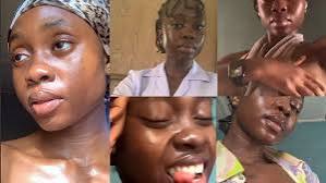 nurse yahweh viral video || nurse yahweh orginal leaked video || Nurse Yahweh Viral Video Leaked Original Link on TikTok X Trending Now